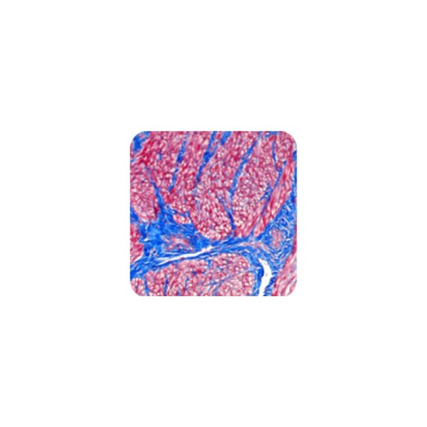 Trichrome Stain Kit